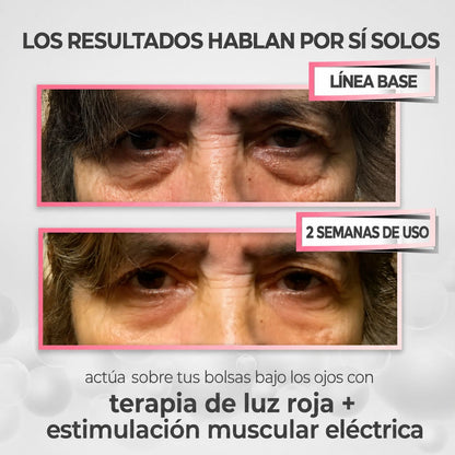 RedEye Beauty™ 2 en 1: Terapia de Luz Roja + EMS para Eliminar las Bolsas Bajo los Ojos
